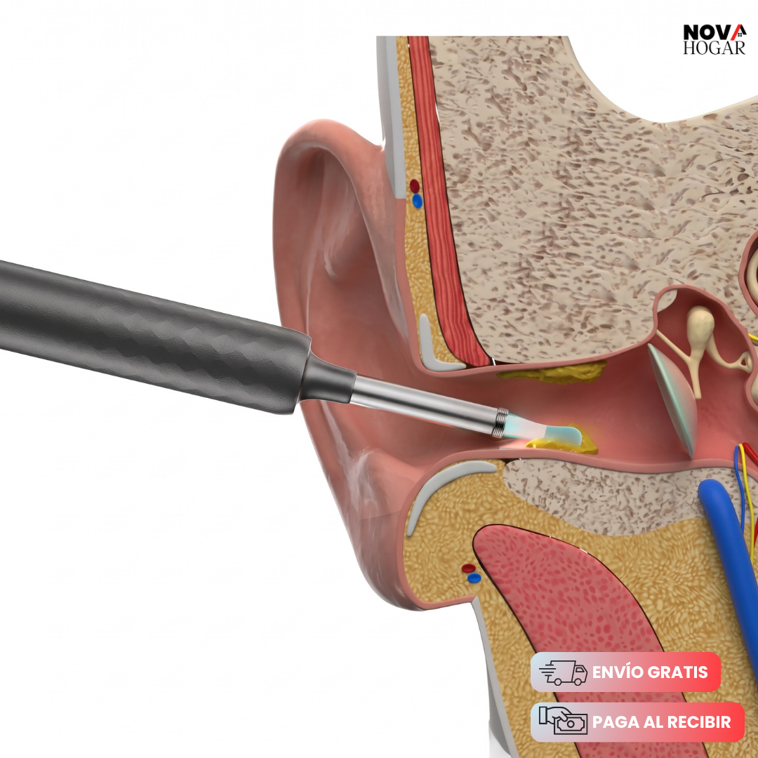 EarSafe™ Limpiador De Oídos Con Cámara
