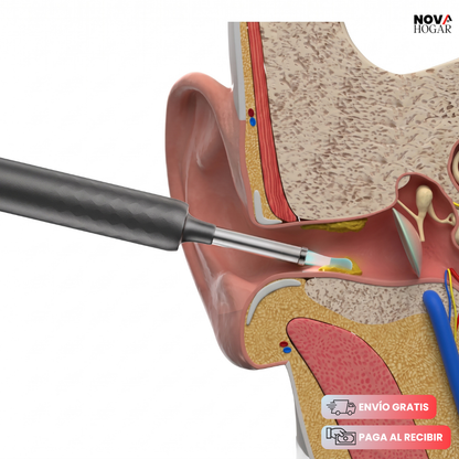 EarSafe™ Limpiador De Oídos Con Cámara