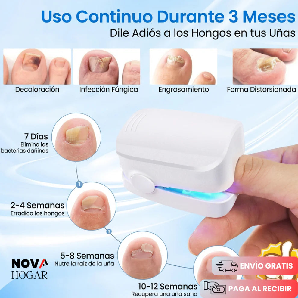 FungusPulse™ Dispositivo Láser Profesional Antihongos
