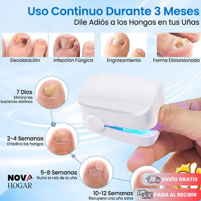 FungusPulse™ Dispositivo Láser Profesional Antihongos